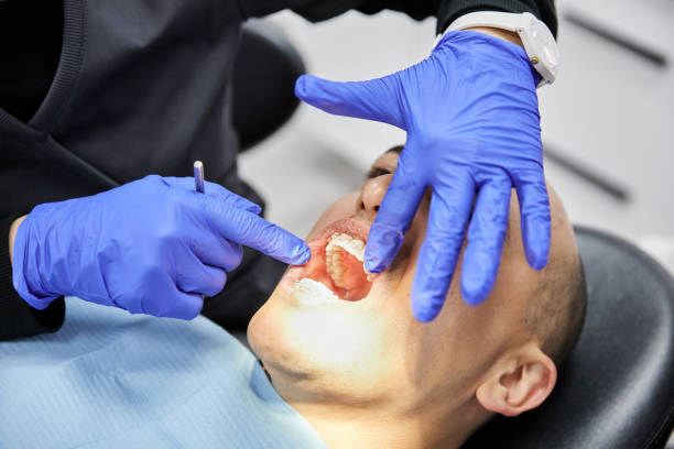 Best Emergency Treatment for Dental Infections or Abscesses in Mckee City, NJ